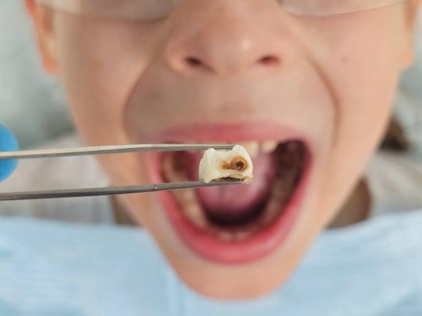Best Orthodontic Emergency Dentist in Goose Creek, SC